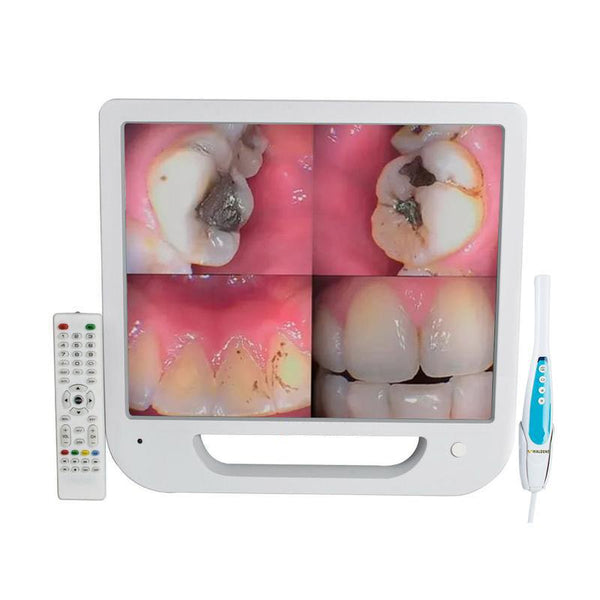 Intra Oral Camera