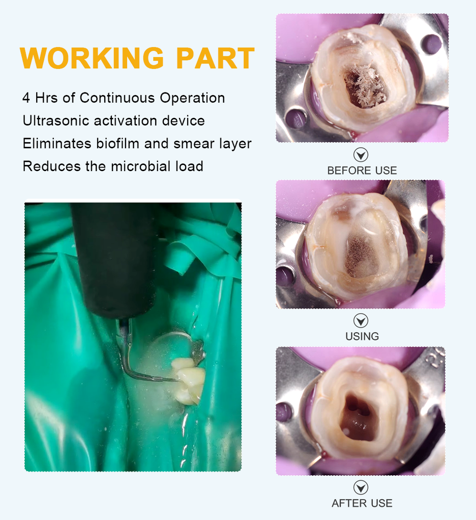 Endo Ultra Activator