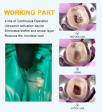 Endo Ultra Activator