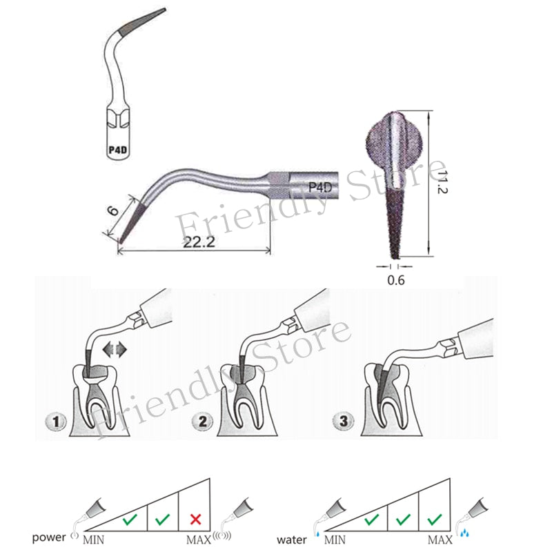 5Pc Endo Tip P4D Diamond coated Dental Scaler Tip For Ultrasonic Scaler Handpiece To Preparing Good Endo Jaws Fit EMS/Woodpecker