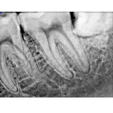 X-Ray Series - X-Ray Sensors RVG Medical Equipment HDR-500