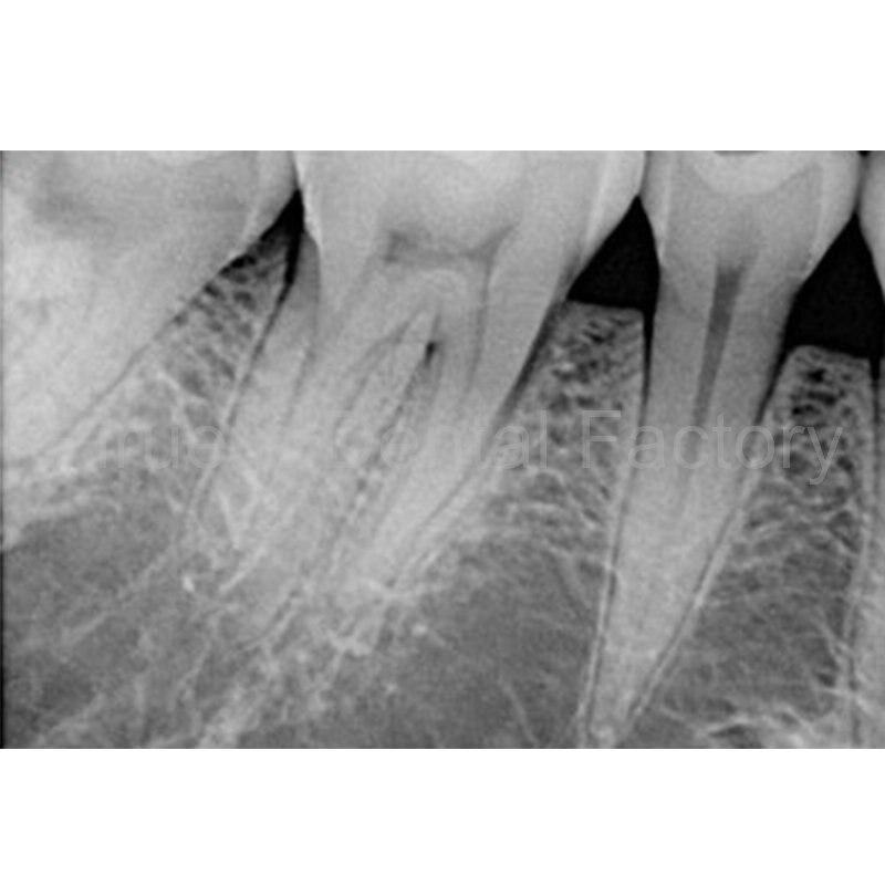X-Ray Series - X-Ray Sensors RVG Medical Equipment HDR-500