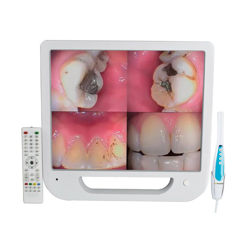 All-in-one Endoscope System Dental WiFi Intra Oral Camera PIP Monitor Intraoral HD Teeth Cleaning